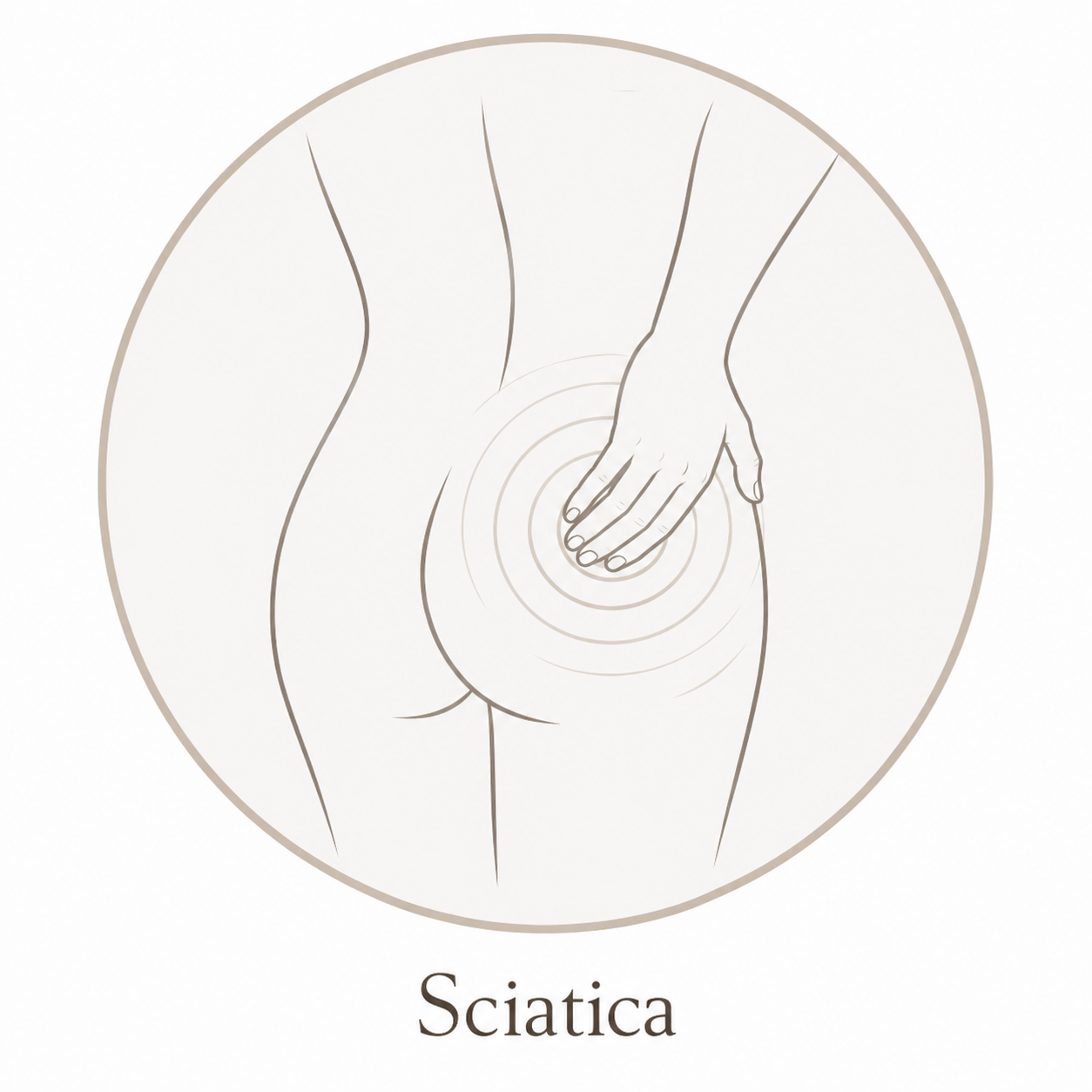 Sciatica